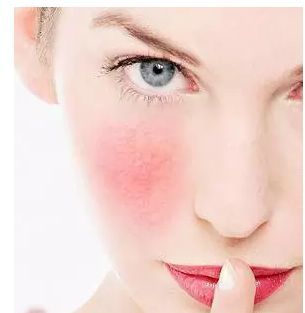 拿什么拯救你，紅血絲小姐