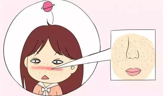 女生毛孔粗大到底應該怎么辦？